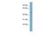 Core 1 Synthase, Glycoprotein-N-Acetylgalactosamine 3-Beta-Galactosyltransferase 1 antibody, GTX46062, GeneTex, Western Blot image 