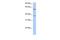 Nucleoporin 43 antibody, GTX45155, GeneTex, Western Blot image 