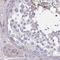 EPS8 Like 1 antibody, NBP2-33288, Novus Biologicals, Immunohistochemistry paraffin image 