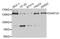 DNA Methyltransferase 3 Alpha antibody, LS-C334760, Lifespan Biosciences, Western Blot image 