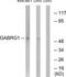 Gamma-Aminobutyric Acid Type A Receptor Gamma1 Subunit antibody, TA313908, Origene, Western Blot image 