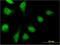 Prefoldin Subunit 2 antibody, H00005202-M07, Novus Biologicals, Immunocytochemistry image 