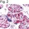 HIF1-alpha antibody, PA1-16601, Invitrogen Antibodies, Immunohistochemistry paraffin image 