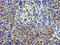 Lipoprotein Lipase antibody, M00316-1, Boster Biological Technology, Immunohistochemistry paraffin image 