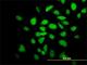 Calcium/Calmodulin Dependent Protein Kinase II Alpha antibody, H00000815-M01, Novus Biologicals, Immunofluorescence image 