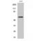 Nuclear Receptor Subfamily 4 Group A Member 1 antibody, LS-C385004, Lifespan Biosciences, Western Blot image 