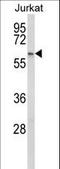 Propionyl-CoA Carboxylase Subunit Beta antibody, LS-C163411, Lifespan Biosciences, Western Blot image 
