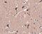 Zinc Finger Protein 667 antibody, PA5-20769, Invitrogen Antibodies, Immunohistochemistry paraffin image 