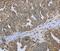 Dynactin Subunit 4 antibody, PA5-50392, Invitrogen Antibodies, Immunohistochemistry frozen image 