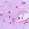 MutS Homolog 6 antibody, LS-C352291, Lifespan Biosciences, Immunohistochemistry frozen image 