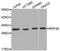 Ribonuclease P/MRP Subunit P30 antibody, A07553, Boster Biological Technology, Western Blot image 