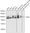 Cysteinyl-TRNA Synthetase antibody, GTX65912, GeneTex, Western Blot image 