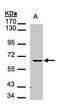 Male Germ Cell Associated Kinase antibody, GTX107556, GeneTex, Western Blot image 