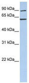 Chaperonin Containing TCP1 Subunit 5 antibody, TA334424, Origene, Western Blot image 