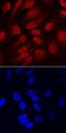 Transcription factor SOX-11 antibody, PA5-47557, Invitrogen Antibodies, Immunocytochemistry image 