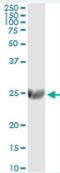ST6 Beta-Galactoside Alpha-2,6-Sialyltransferase 1 antibody, H00006480-M01, Novus Biologicals, Western Blot image 