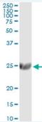 Beta-galactoside alpha-2,6-sialyltransferase 1 antibody, H00006480-M01, Novus Biologicals, Western Blot image 