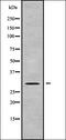 Gem Nuclear Organelle Associated Protein 8 antibody, orb337873, Biorbyt, Western Blot image 