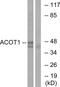 Acyl-CoA Thioesterase 1 antibody, GTX87911, GeneTex, Western Blot image 