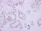 DNA Topoisomerase II Beta antibody, PA5-27750, Invitrogen Antibodies, Immunohistochemistry paraffin image 