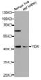 Vitamin D Receptor antibody, LS-C747110, Lifespan Biosciences, Western Blot image 