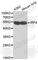 Interferon Regulatory Factor 4 antibody, A1052, ABclonal Technology, Western Blot image 