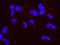 Chromosome Transmission Fidelity Factor 18 antibody, NBP1-03346, Novus Biologicals, Proximity Ligation Assay image 