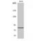 RDX antibody, LS-C385742, Lifespan Biosciences, Western Blot image 