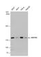 Nucleoporin 155 antibody, NBP2-19609, Novus Biologicals, Western Blot image 