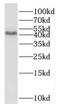 Oxoeicosanoid receptor 1 antibody, FNab06052, FineTest, Western Blot image 