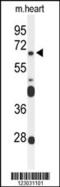 Frizzled Class Receptor 4 antibody, 63-961, ProSci, Western Blot image 