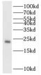 Fortilin antibody, FNab08907, FineTest, Western Blot image 