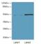 Thyroid Hormone Receptor Interactor 13 antibody, A61518-100, Epigentek, Western Blot image 