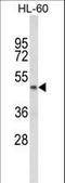 Prostaglandin E Receptor 2 antibody, LS-C162271, Lifespan Biosciences, Western Blot image 