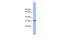 Leucine Rich Repeat Containing 52 antibody, GTX46708, GeneTex, Western Blot image 