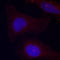 Protein Tyrosine Kinase 2 Beta antibody, LS-C335877, Lifespan Biosciences, Immunofluorescence image 