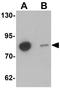 Guanylate Binding Protein Family Member 6 antibody, GTX17166, GeneTex, Western Blot image 