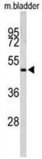 Actin Related Protein 3B antibody, GTX81186, GeneTex, Western Blot image 