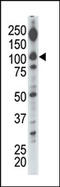 Diglyceride kinase iota antibody, AP15086PU-N, Origene, Western Blot image 