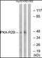 Protein Kinase CAMP-Dependent Type II Regulatory Subunit Beta antibody, orb96019, Biorbyt, Western Blot image 