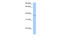 RNA-binding motif protein, Y chromosome, family 1 member A1/C antibody, 29-236, ProSci, Western Blot image 