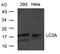 Microtubule Associated Protein 1 Light Chain 3 Alpha antibody, A01543, Boster Biological Technology, Western Blot image 