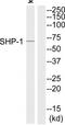 Ribosomal Protein S6 Kinase A5 antibody, TA312507, Origene, Western Blot image 