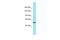 Rho Guanine Nucleotide Exchange Factor 40 antibody, A12518, Boster Biological Technology, Western Blot image 