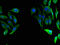 Fumarylacetoacetate Hydrolase antibody, LS-C395866, Lifespan Biosciences, Immunofluorescence image 