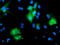 Protein Tyrosine Phosphatase Non-Receptor Type 7 antibody, M07600, Boster Biological Technology, Immunofluorescence image 