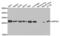 Acidic Nuclear Phosphoprotein 32 Family Member A antibody, abx004416, Abbexa, Western Blot image 