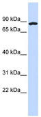 Coiled-Coil Domain Containing 151 antibody, TA340380, Origene, Western Blot image 
