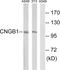 Cyclic Nucleotide Gated Channel Beta 1 antibody, PA5-39118, Invitrogen Antibodies, Western Blot image 
