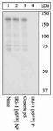 Insulin Receptor Substrate 1 antibody, GTX24776, GeneTex, Western Blot image 